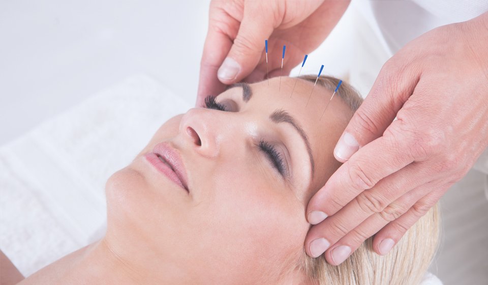Acupuncture-service